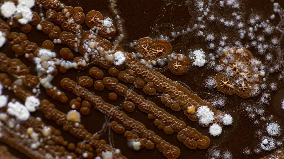 Taken from soil samples, a colony of bacteria and mold are growing on agar plates in a microbiology laboratory.